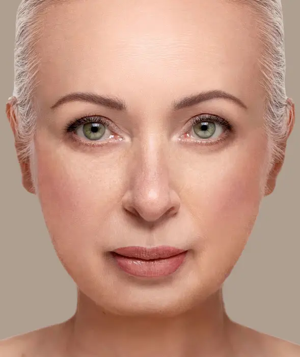 Skin Tightening after