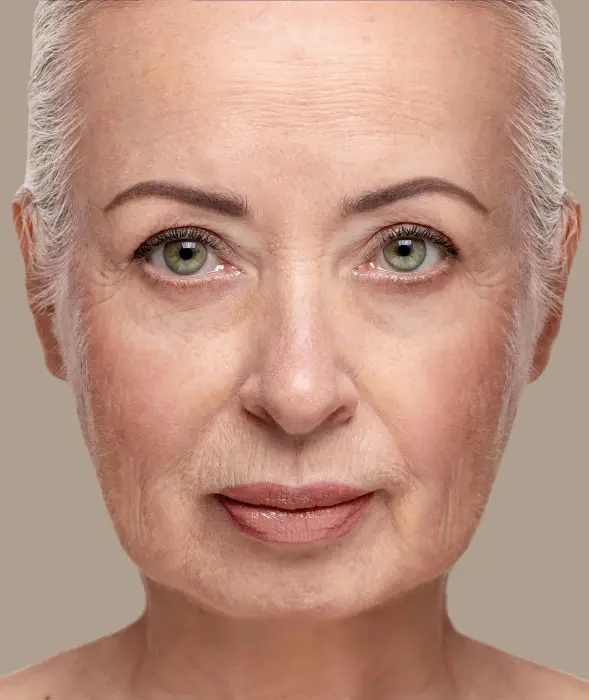 Skin Tightening before