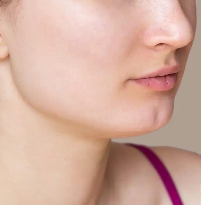 microdermabrasion after